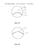 Multifocal Lens Having a Progressive Optical Power Region and     Discontinuity diagram and image