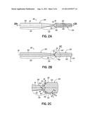 Bur and Method of Making Same diagram and image