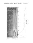 SYSTEMS AND METHODS FOR DIAGNOSING VIRAL INFECTIONS diagram and image