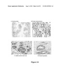 ARL-1 SPECIFIC ANTIBODIES AND USES THEREOF diagram and image