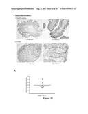 ARL-1 SPECIFIC ANTIBODIES AND USES THEREOF diagram and image