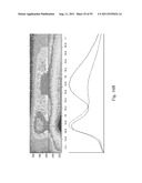 SYSTEMS AND METHODS FOR DIAGNOSING FUNGAL INFECTIONS diagram and image