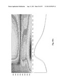 SYSTEMS AND METHODS FOR DETERMINING CARDIAC CONDITIONS diagram and image