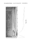 SYSTEMS AND METHODS FOR DETERMINING CARDIAC CONDITIONS diagram and image