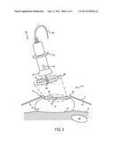 System and Method for Fetal Heart Monitoring Using Ultrasound diagram and image