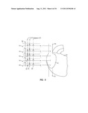 APPARATUS AND METHOD FOR CATHETER NAVIGATION AND TIP LOCATION diagram and image