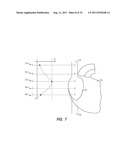 APPARATUS AND METHOD FOR CATHETER NAVIGATION AND TIP LOCATION diagram and image