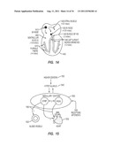 APPARATUS AND METHOD FOR CATHETER NAVIGATION AND TIP LOCATION diagram and image