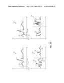 APPARATUS AND METHOD FOR CATHETER NAVIGATION AND TIP LOCATION diagram and image