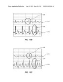 APPARATUS AND METHOD FOR CATHETER NAVIGATION AND TIP LOCATION diagram and image