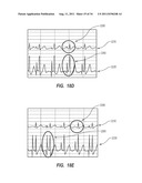 APPARATUS AND METHOD FOR CATHETER NAVIGATION AND TIP LOCATION diagram and image