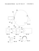 ULTRASOUND NEUROMODULATION OF THE OCCIPUT diagram and image