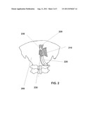 ULTRASOUND NEUROMODULATION OF THE OCCIPUT diagram and image