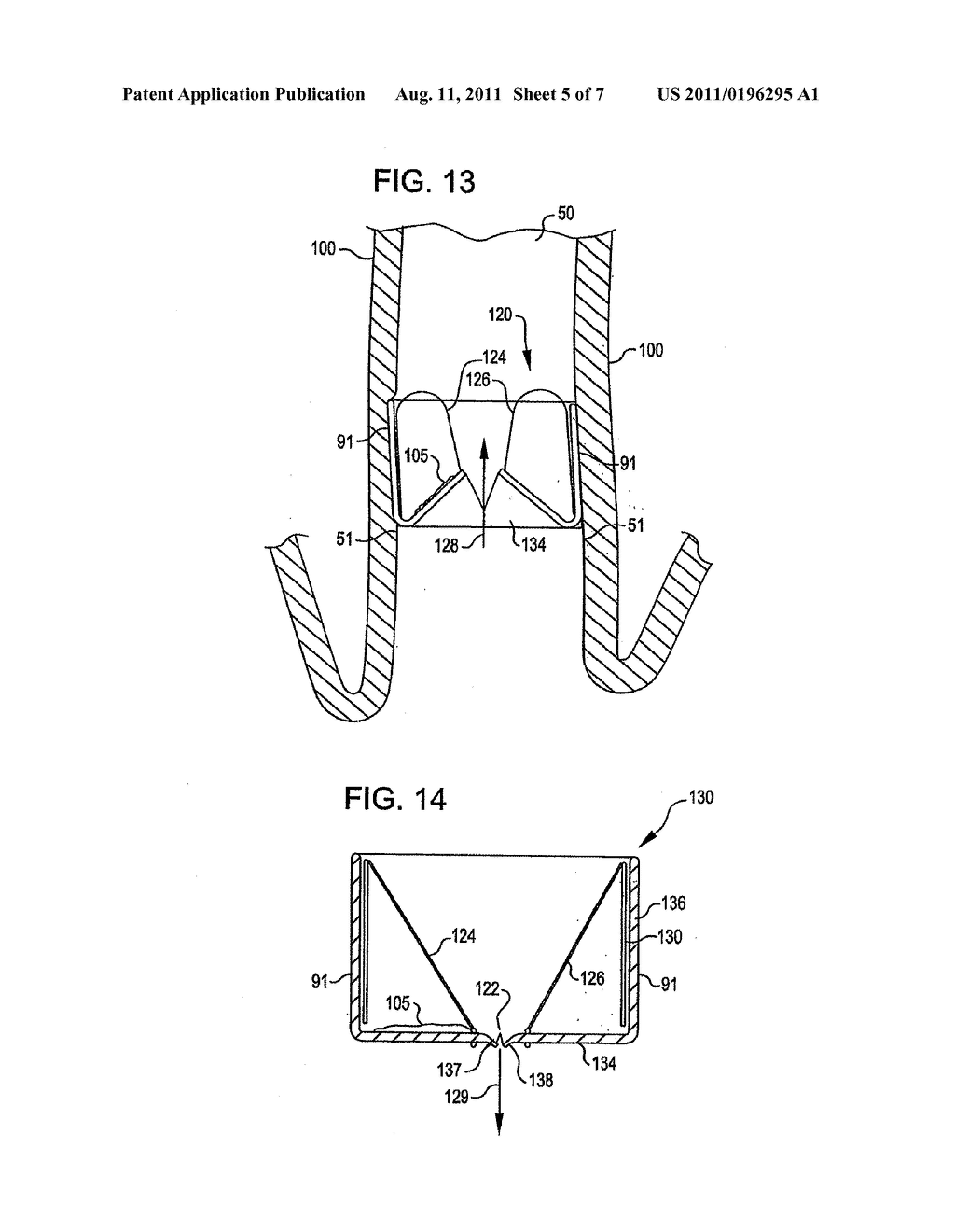 DEVICE AND METHOD FOR INTRA-BRONCHIAL PROVISION OF A THERAPEUTIC AGENT - diagram, schematic, and image 06