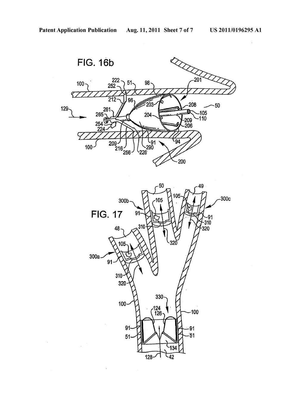 DEVICE AND METHOD FOR INTRA-BRONCHIAL PROVISION OF A THERAPEUTIC AGENT - diagram, schematic, and image 08