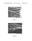 Absorbent Article with Bonded Web Material diagram and image