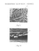 Absorbent Article with Bonded Web Material diagram and image