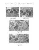 Absorbent Article with Bonded Web Material diagram and image