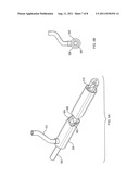 METHOD AND DEVICE FOR VASCULAR TREATMENT diagram and image