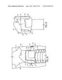 One Way Sliding Device for Intramedullary Intertrochanteric Fixation     Implants diagram and image