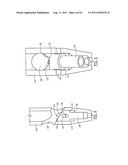 One Way Sliding Device for Intramedullary Intertrochanteric Fixation     Implants diagram and image