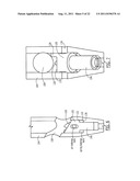 One Way Sliding Device for Intramedullary Intertrochanteric Fixation     Implants diagram and image