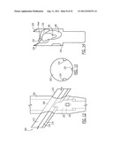 One Way Sliding Device for Intramedullary Intertrochanteric Fixation     Implants diagram and image