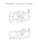 One Way Sliding Device for Intramedullary Intertrochanteric Fixation     Implants diagram and image