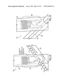 One Way Sliding Device for Intramedullary Intertrochanteric Fixation     Implants diagram and image