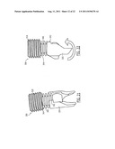 One Way Sliding Device for Intramedullary Intertrochanteric Fixation     Implants diagram and image