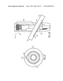 One Way Sliding Device for Intramedullary Intertrochanteric Fixation     Implants diagram and image