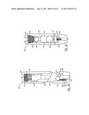 One Way Sliding Device for Intramedullary Intertrochanteric Fixation     Implants diagram and image