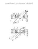 One Way Sliding Device for Intramedullary Intertrochanteric Fixation     Implants diagram and image