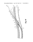 VASCULAR SUTURING DEVICE diagram and image