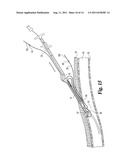 VASCULAR SUTURING DEVICE diagram and image