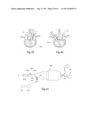 ULTRASONIC SURGICAL INSTRUMENTS WITH ROTATABLE BLADE AND HOLLOW SHEATH     ARRANGEMENTS diagram and image