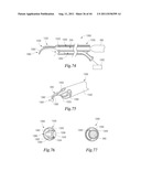 ULTRASONIC SURGICAL INSTRUMENTS WITH ROTATABLE BLADE AND HOLLOW SHEATH     ARRANGEMENTS diagram and image