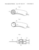 COMPOSITION, METHOD AND DEVICE FOR STABILIZING IMPLANTED HYDRAULIC DEVICES diagram and image