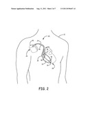 IMPLANTABLE MEDICAL DEVICE WITH AN ELECTRONIC PRESCRIPTION diagram and image