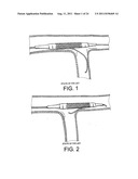 Navigation Guide Wire Through an Anatomical Structure Having Branched     Ducts diagram and image