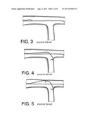 Navigation Guide Wire Through an Anatomical Structure Having Branched     Ducts diagram and image