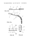 Navigation Guide Wire Through an Anatomical Structure Having Branched     Ducts diagram and image