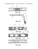 Navigation Guide Wire Through an Anatomical Structure Having Branched     Ducts diagram and image