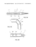 Navigation Guide Wire Through an Anatomical Structure Having Branched     Ducts diagram and image