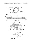 POST-OPERATIVE ADJUSTMENT TOOL, MINIMALLY INVASIVE ATTACHMENT APPARATUS,     AND ADJUSTABLE TRICUSPID RING diagram and image