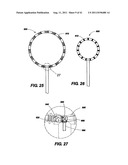 POST-OPERATIVE ADJUSTMENT TOOL, MINIMALLY INVASIVE ATTACHMENT APPARATUS,     AND ADJUSTABLE TRICUSPID RING diagram and image