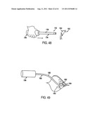 POST-OPERATIVE ADJUSTMENT TOOL, MINIMALLY INVASIVE ATTACHMENT APPARATUS,     AND ADJUSTABLE TRICUSPID RING diagram and image