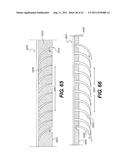 POST-OPERATIVE ADJUSTMENT TOOL, MINIMALLY INVASIVE ATTACHMENT APPARATUS,     AND ADJUSTABLE TRICUSPID RING diagram and image