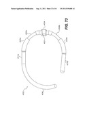 POST-OPERATIVE ADJUSTMENT TOOL, MINIMALLY INVASIVE ATTACHMENT APPARATUS,     AND ADJUSTABLE TRICUSPID RING diagram and image