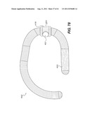 POST-OPERATIVE ADJUSTMENT TOOL, MINIMALLY INVASIVE ATTACHMENT APPARATUS,     AND ADJUSTABLE TRICUSPID RING diagram and image